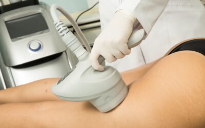 TRYNEA®: radiofrequência na redução de celulite