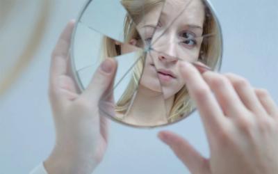Autoestima: como a celulite impacta a confiança feminina