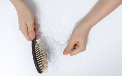 Queda de cabelo: causas mais comuns