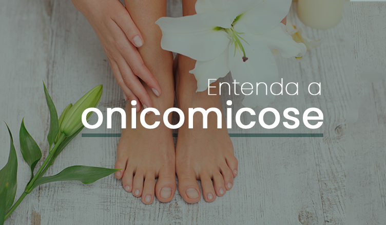 Conheça a solução para onicomicose