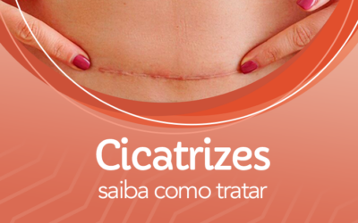 É possível remover cicatrizes? Saiba como tratar