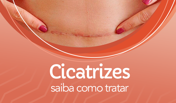 É possível remover cicatrizes? Saiba como tratar