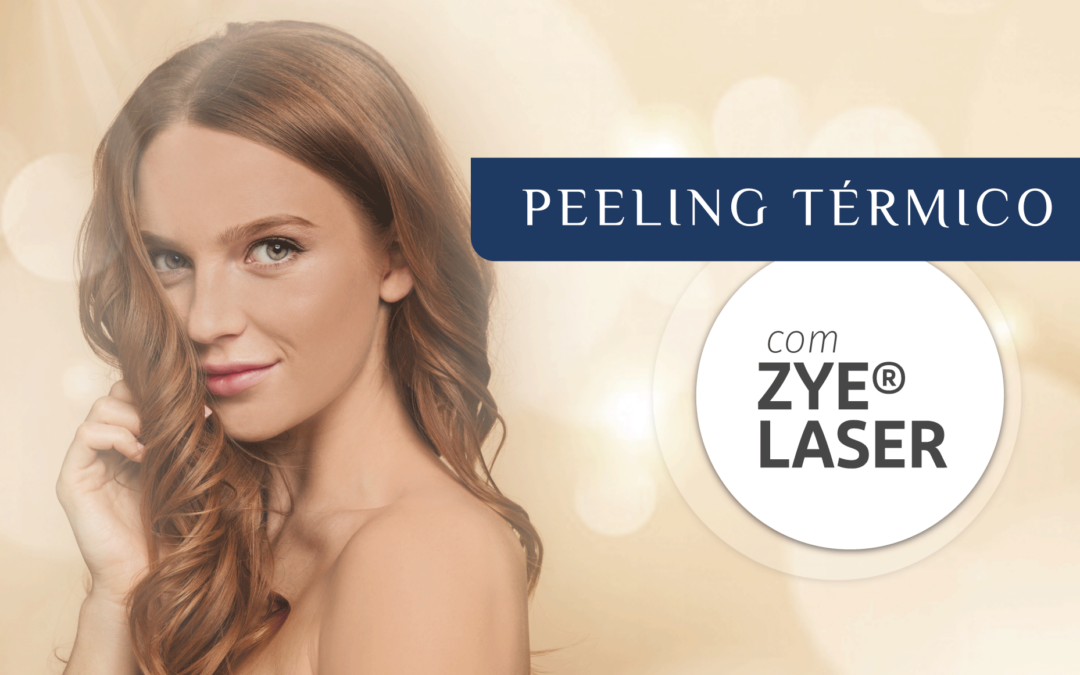 Peeling térmico é mais rápido com LASER