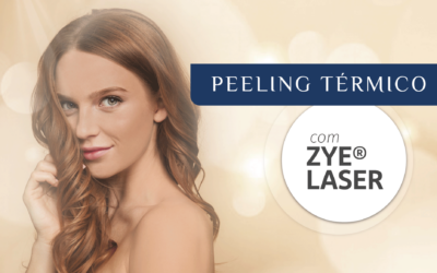 Peeling térmico é mais rápido com LASER