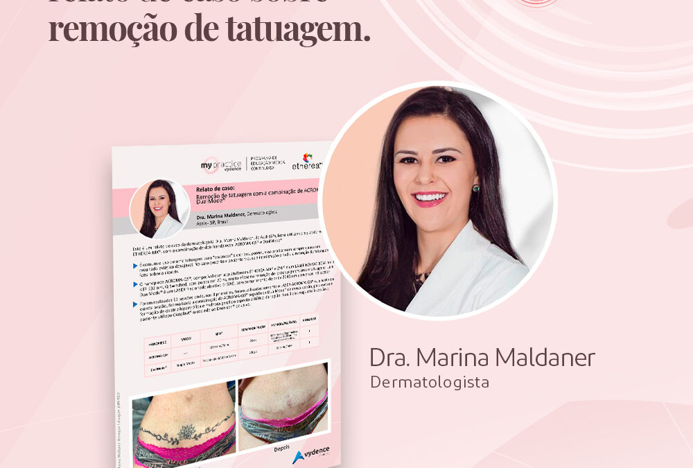 Confira o relato de caso de remoção de tatuagem